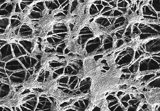 Microstructure of POREFLON™